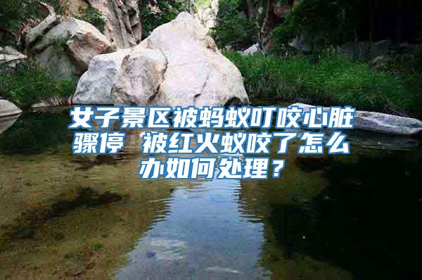 女子景區被螞蟻叮咬心臟驟停 被紅火蟻咬了怎么辦如何處理？